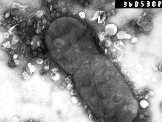 Rotaviry a bakterie
