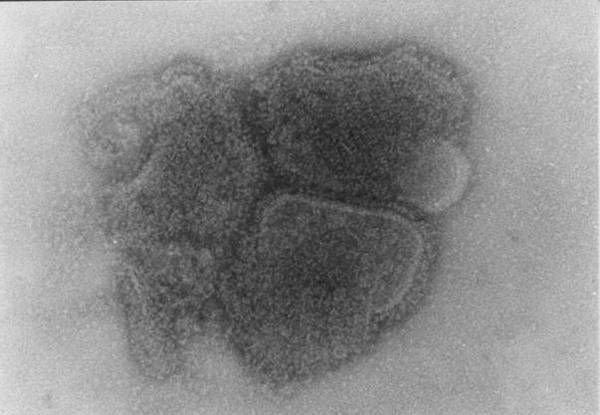 Paramyxoviridae