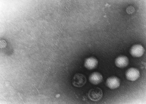 Adenoviry a polyomyviry BK