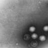 Adenoviry a polyomyviry BK