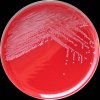 Enterococcus gallinarum, Columbia agar