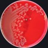 Escherichia coli, Enterococcus faecalis.