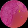Vibrio cholerae non O1 - MacConkey agar, 18h, aerobne (drobné růžové = VICHO)