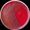 Enterococcus casseliflavus