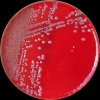 Salmonella infantis, Klebsiella pneumoniae, Enterobacter cloacae