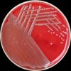 Acinetobacter baumannii, Columbia agar, 36°C, 24h, aerobně. 