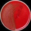 Streptococcus pneumoniae, Columbia agar, 36°C, 24h, C02. 