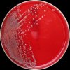 Shigella boydii, Columbia agar, 36°C, 24h, aerobně