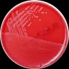 Streptococcus agalactiae, Columbia agar, 36°C, 24h, aerobně