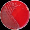 Salmonella hadar, Escherichia coli, Klebsiella oxytoca