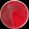 Enterococcus faecium, COL agar