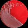 Escherichia coli O26, COL agar