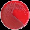 Escherichia coli, Col agar