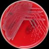 Staphylococcus lugdunensis, Columbia agar