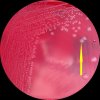 Clostridium sordellii, Columbia agar, anaerobně