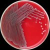 Klebsiella pneumoniae, Columbia agar