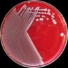Klebsiella pneumoniae, Escherichia coli