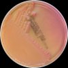 Klebsiella pneumoniae, Escherichia coli