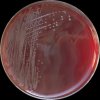Salmonella Typhimurium, Escherichia coli, Proteus mirabilis