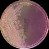 Salmonella Typhimurium, Escherichia coli, Proteus mirabilis