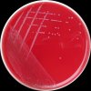 Enterococcus faecalis, COL agar