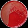Staphylococcus aureus, Streptococcus pyogenes