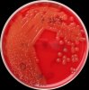 Streptococcus pyogenes+Streptococcus mutans+Neisseria lactamica