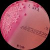 Vibrio cholerae non-O1/non-O139+Escherichia coli+Enterococcus faecalis