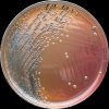 Salmonella Typhimurium, DC agar