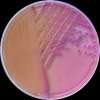 Klebsiella oxytoca, MAC agar