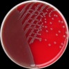 Escherichia coli O145., COL agar