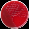 Enterococcus faecium