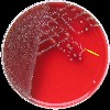 Plesiomonas shigelloides COL agar