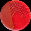 Streptococcus sk.G, Columbia agar