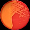 Streptococcus sk.G, Columbia agar