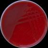 Arcanobacterium haemolyticum, Columbia agar