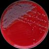 Escherichia coli, Enterococcus faecalis, Enterobacter cloaceae, Columbia agar