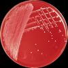 Staphylococcus epidermidis, COL agar