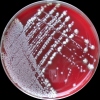 Campylobacter jejuni, COL agar
