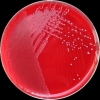 Enterococcus faecalis, COL agar