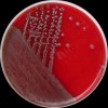 Escherichia coli O157, Columbia agar