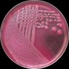 Escherichia coli O157, MC agar
