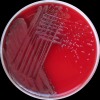Burkholderia cepacia komplex + Streptococcus oralis, Columbia agar