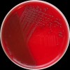 Enterococcus casseliflavus, Columbia agar