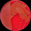Streptococcus sk.C + Neisseria lactamica, Streptococcus oralis, Columbia agar
