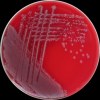 Shigella flexneri + Escherichia coli, Enterococcus faecalis, Columbia agar