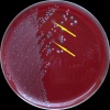 Clostridium difficile + Enterococcus faecalis + Escherichia coli, Columbia agar