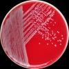 Staphylococcus saprophyticus, Columbia agar