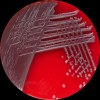 Klebsiella pneumoniae + Escherichia coli, Columbia agar