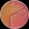 Klebsiella pneumoniae + Escherichia coli, MacConkey agar